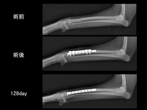 クロエちゃん：橈骨尺骨骨折